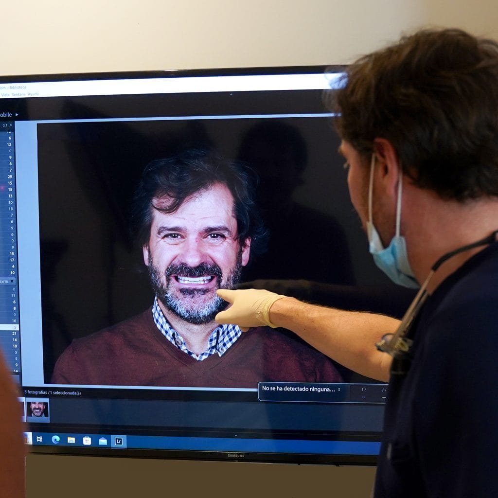 Diseño digital de la sonrisa en CIMA Dental: planificación de la sonrisa por ordenador en Mirasierra, Madrid