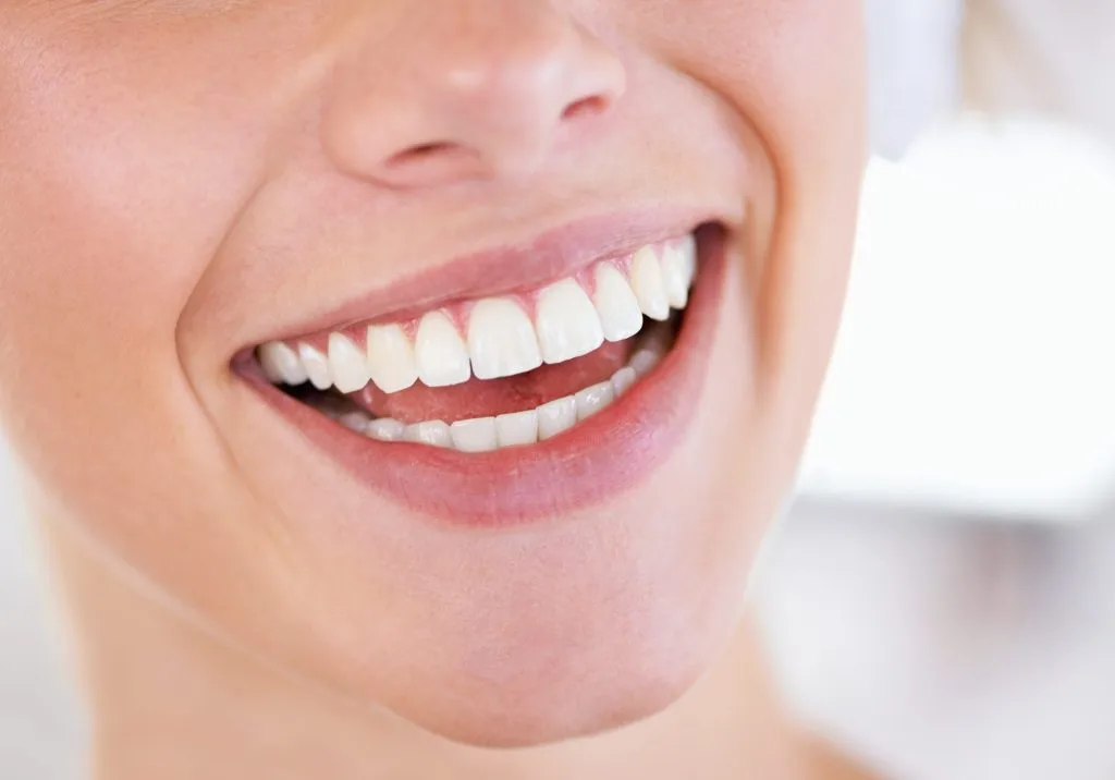 Sonrisa con dientes blancos tras un blanqueamiento dental en CIMA Dental, Madrid